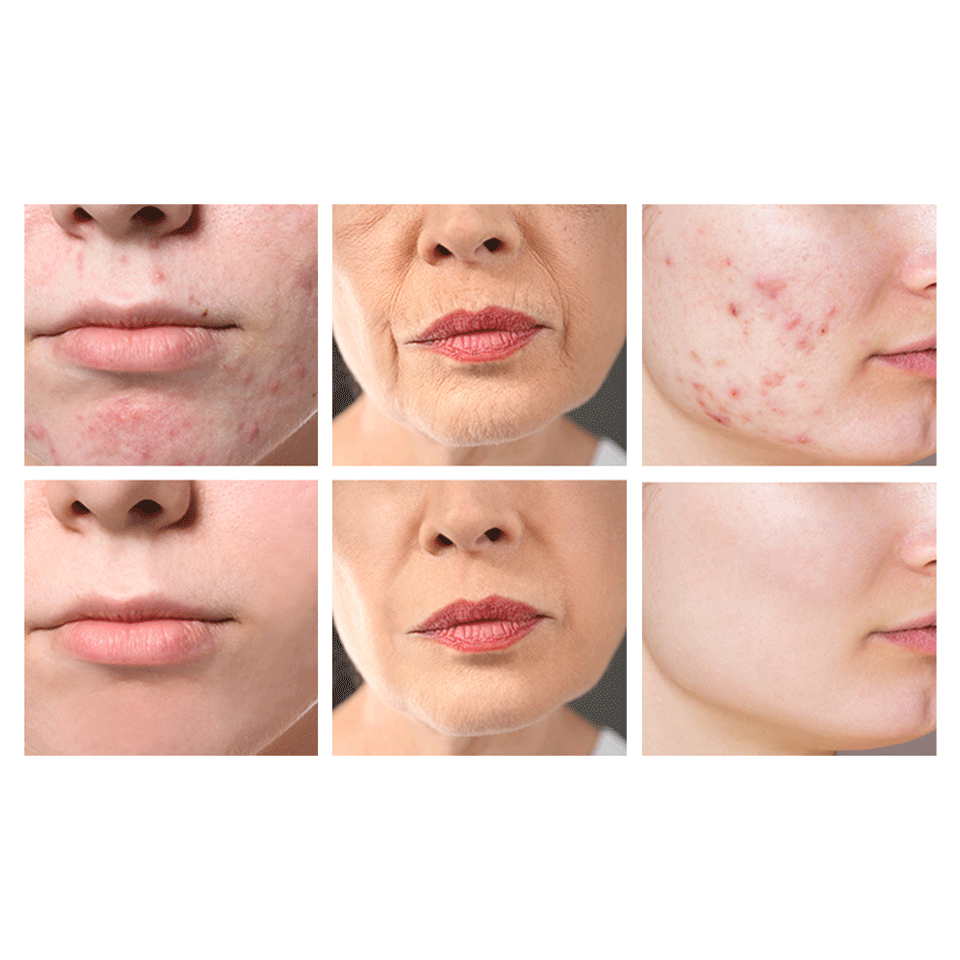 Set de 2 crèmes à l'escargot (remède miracle pour votre visage) CELTONE – Image 4